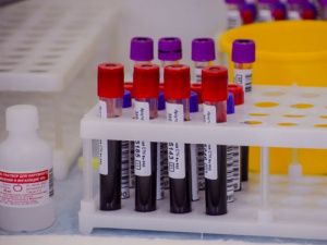 В Югре стартовала акция-марафон «Оставайтесь донором»