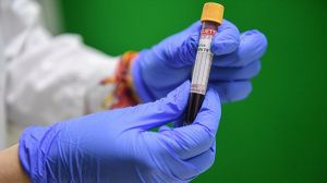Роспотребнадзор ограничил срок выполнения теста на коронавирус