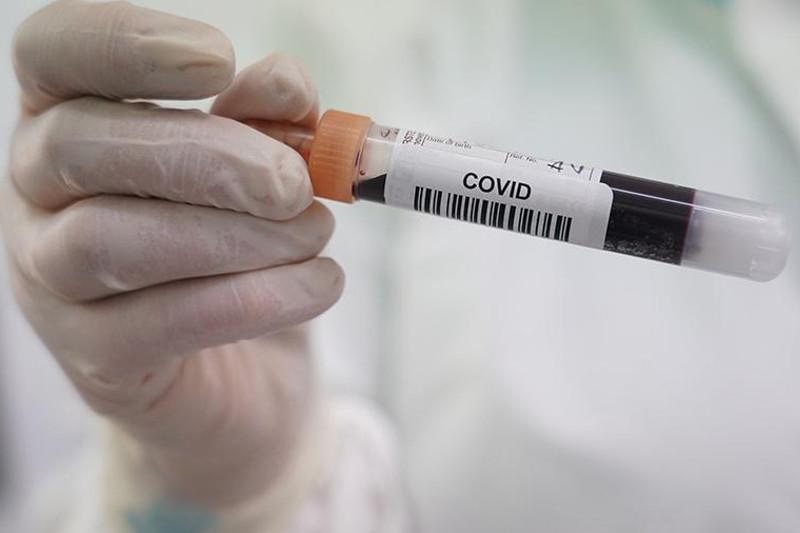 В 12 муниципалитетах Югры COVID-19 не зарегистрирован