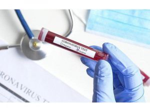 Оперативная информация о новых случаях выявления COVID-19 в Югре на 24 июня